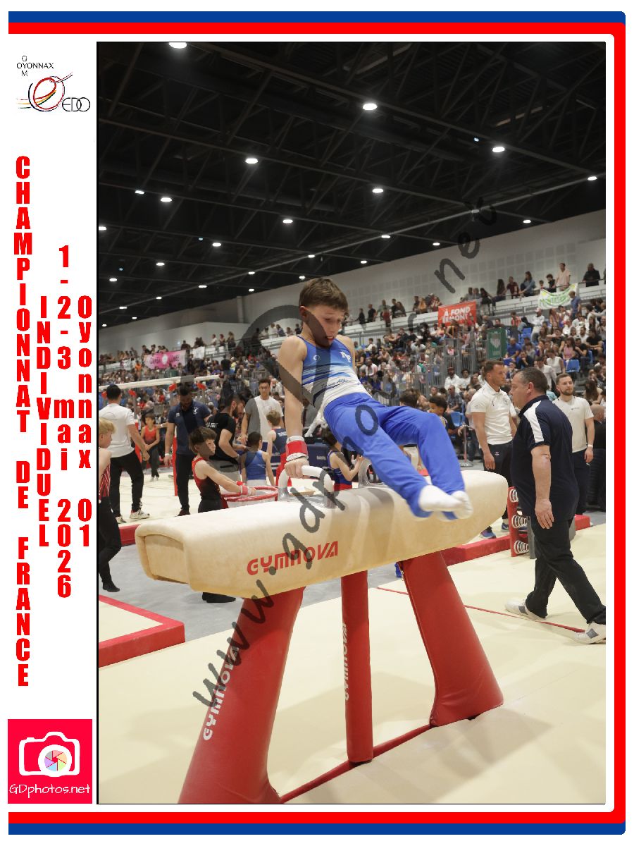 5339209