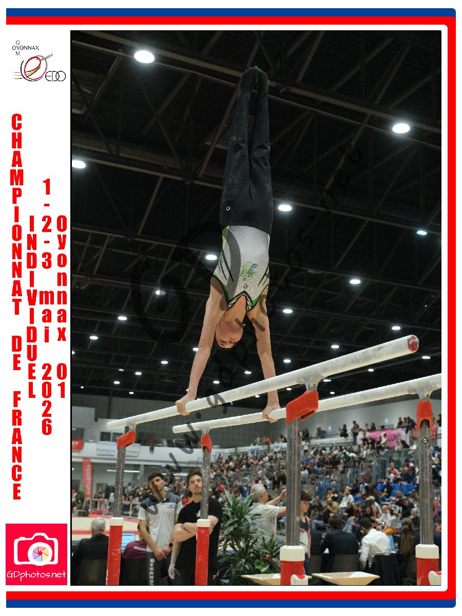 5356378