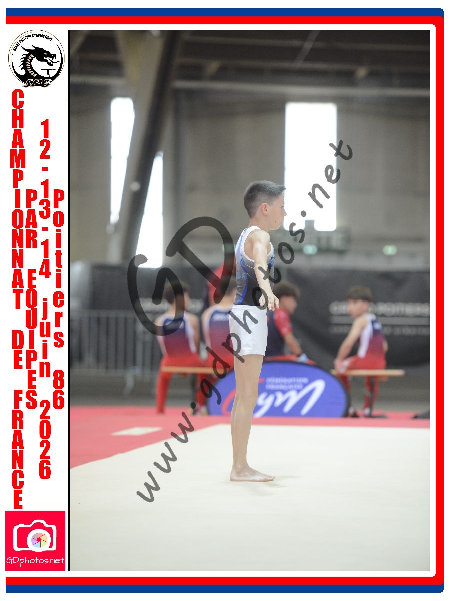 5418571